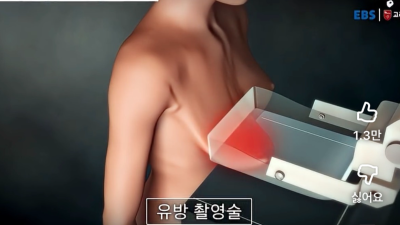 유방 촬영술이 아픈 이유