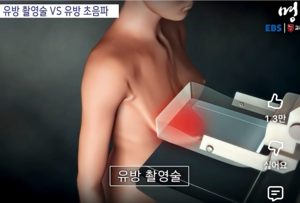 유방 촬영술이 아픈 이유