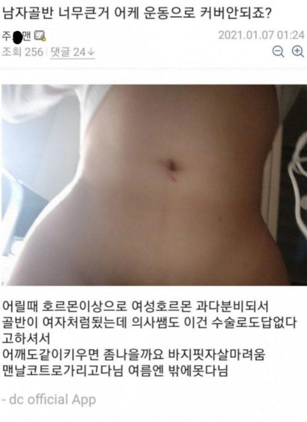 골반이 너무 커 고민인 디시인