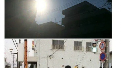 코털을 순간접착제로 뽑은 후기