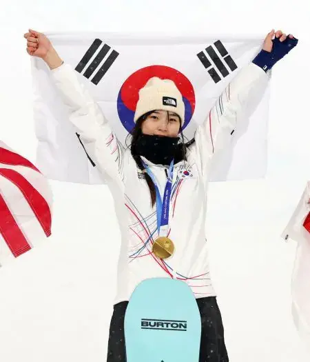 세상에 이런일이 나왔던 9살 꼬맹이 근황