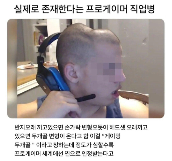 헤드셋을 오래끼면 안되는 이유