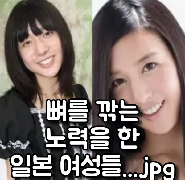 일본 AV배우 성형 전 후 차이