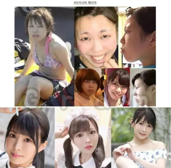 일본 AV배우 성형 전 후 차이