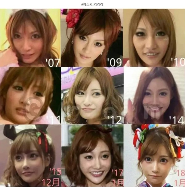 일본 AV배우 성형 전 후 차이