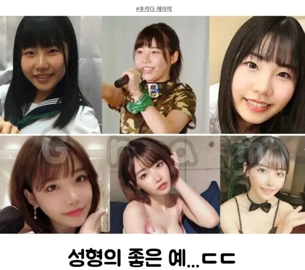 일본 AV배우 성형 전 후 차이