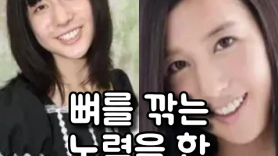 일본 AV배우 성형 전 후 차이