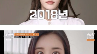 성형에 3억쓴 여자