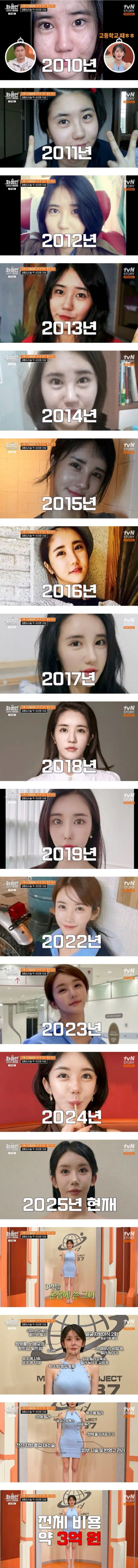 성형에 3억쓴 여자