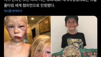 동생을 위해 개와 싸운 6살 소년